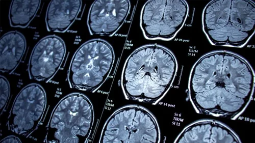 MRI Reporting